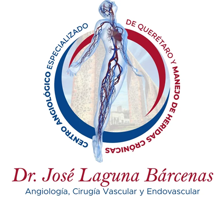 Angiología, Cirugía Vascular y Endovascular en
                             Querétaro, México - Dr. José Laguna Bárcenas